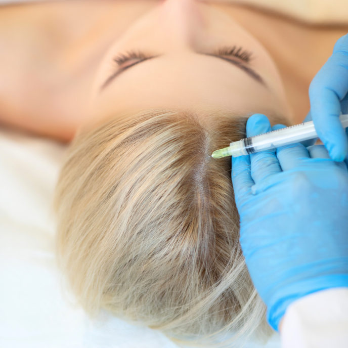 PRP injections for women's scalps